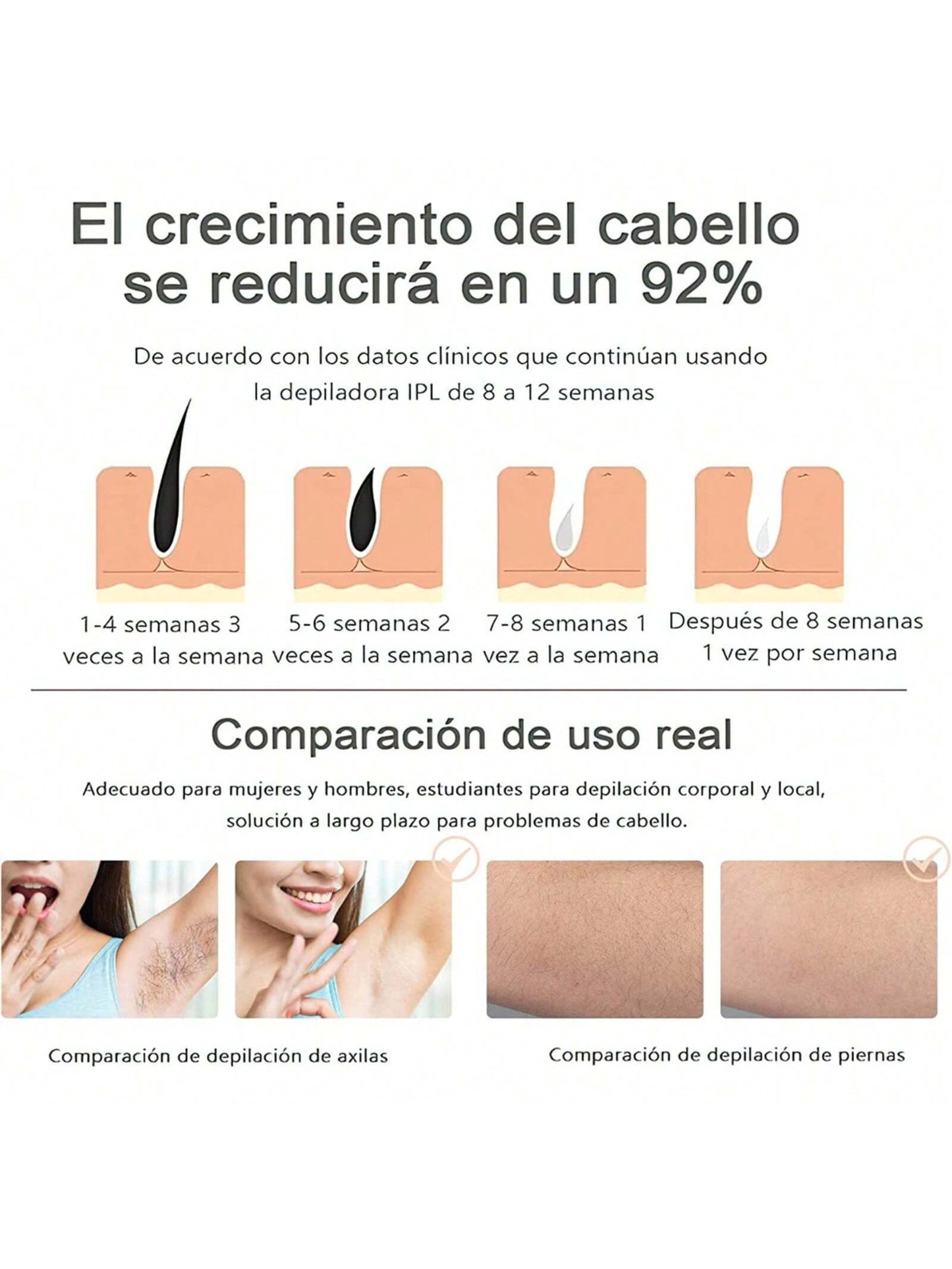 Depiladora de laser IPL